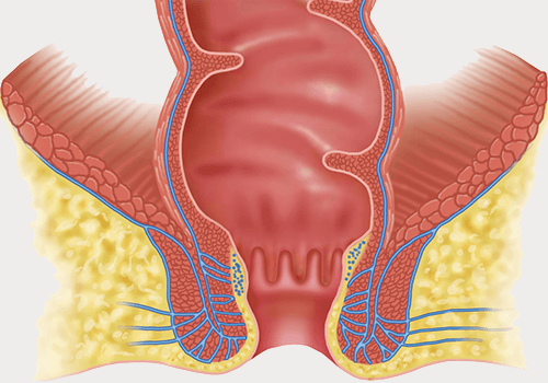 Anorectal Diseases Treatment Specialist in Bhosari